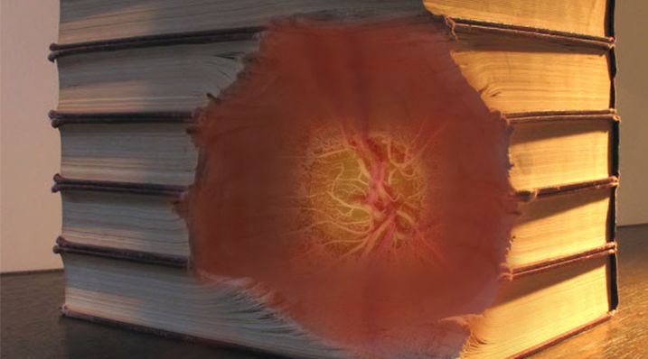 Understanding Multifocal Choroiditis Through Angio-OCT