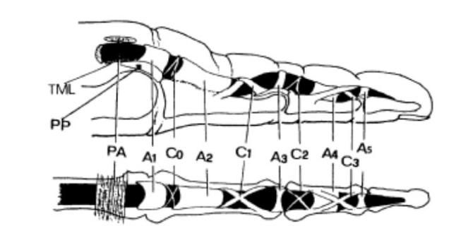 MRI of Finger Tendons
