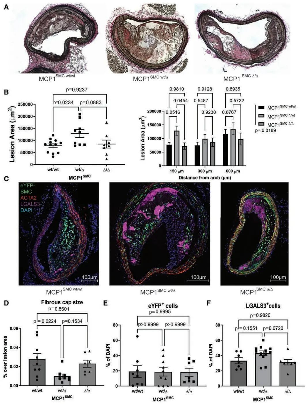 Dichotomous Roles of Smooth Muscle Cell-Derived MCP1 in Atherosclerosis Development