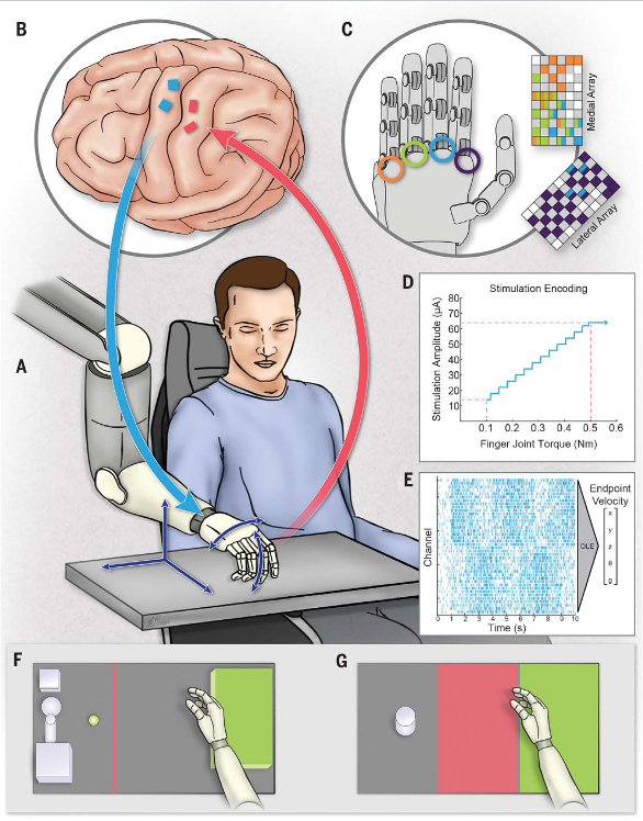 Is Mind Reading Real? How Brain-Machine Interfaces Propel Humanity Towards Transhumanism