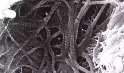 Understanding Self-Etching and Total Etching Techniques