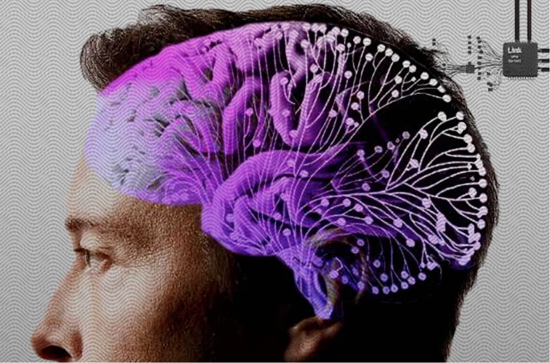 Is Mind Reading Real? How Brain-Machine Interfaces Propel Humanity Towards Transhumanism