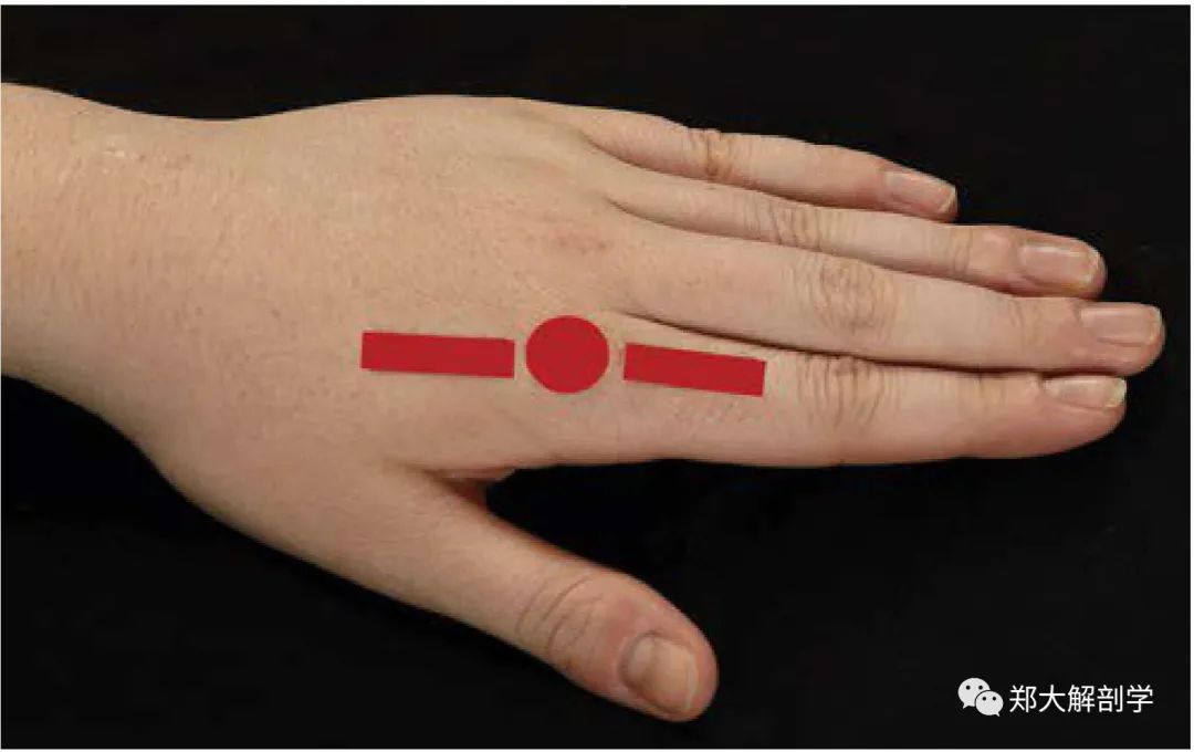 MCP or PIP/DIP Joint Extension Assessment