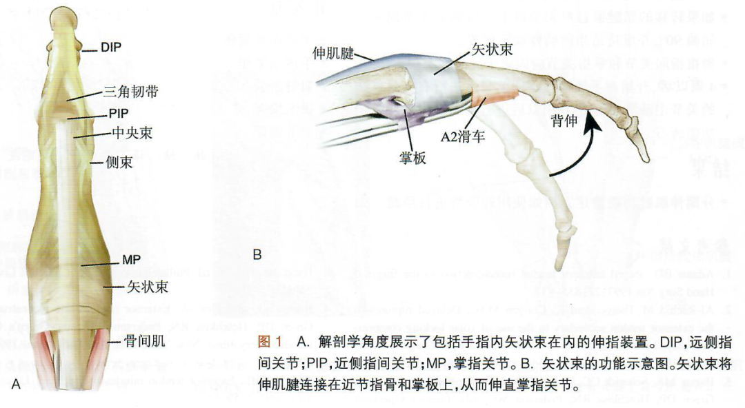 Surgical Techniques for Treating Traumatic MCP Joint Subluxation (Part 1)