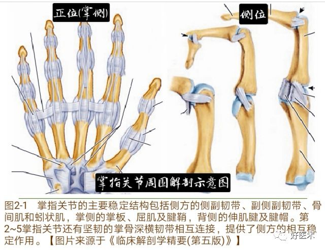 Key Points in the Diagnosis and Treatment of Metacarpophalangeal Joint Dislocation