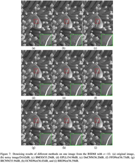 Comprehensive Overview of Deep Learning in Image Denoising