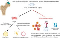Inflammation, Bone Healing, and Osteonecrosis: From Clinic to Laboratory