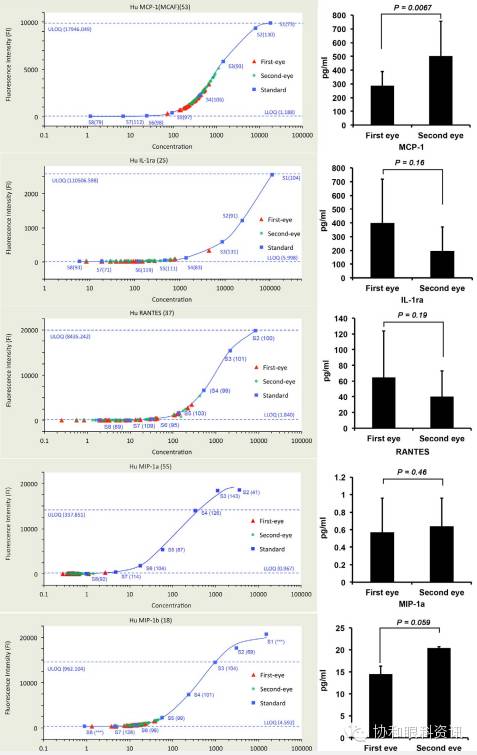 Why Is the Contralateral Eye More Sensitive During Cataract Surgery?