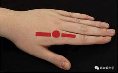 MCP or PIP/DIP Joint Extension Assessment