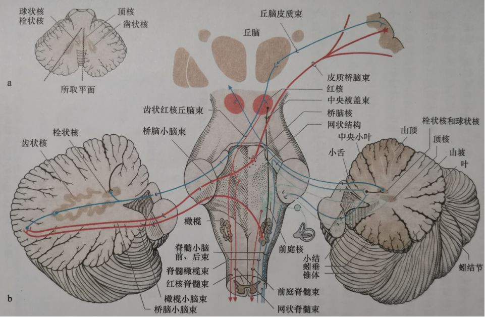 Claude Syndrome: Clinical Report and Analysis