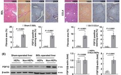 Macrophage-Specific FGF12 Promotes Liver Fibrosis Progression in Mice