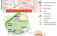 MCPIP1 Regulates Atf3-Ap1s2 Pathway to Limit Mucosal Inflammation