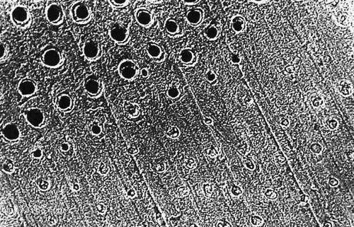 Understanding Self-Etching and Total Etching Techniques