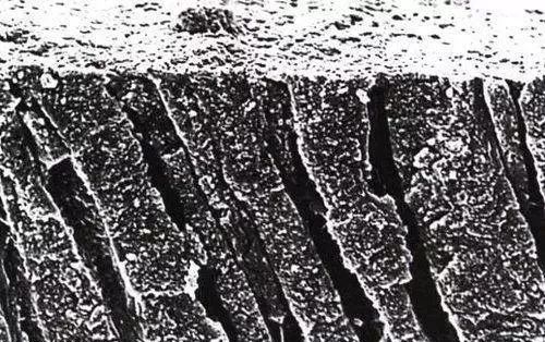 Understanding Self-Etching and Total Etching Techniques