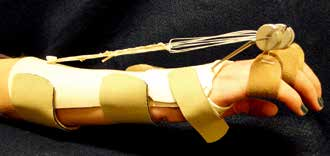 MCP And PIP Joint Arthroplasty - AAOS Orthopedic Postoperative Rehabilitation Guidelines