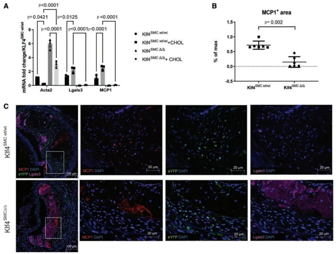 Dichotomous Roles of Smooth Muscle Cell-Derived MCP1 in Atherosclerosis Development