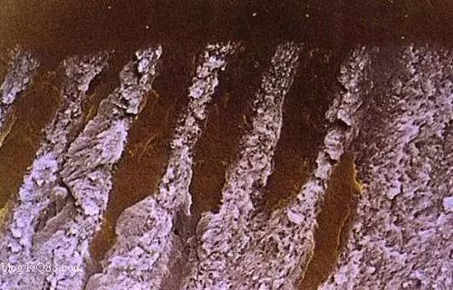 Understanding Self-Etching and Total Etching Techniques