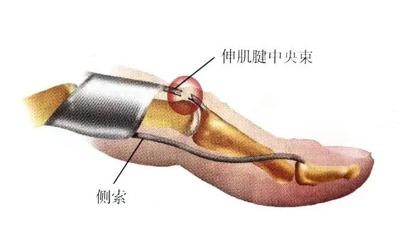 Key Points of Three Types of Hand Joint Injuries