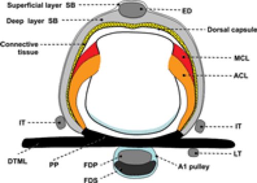 MRI of Finger Tendons