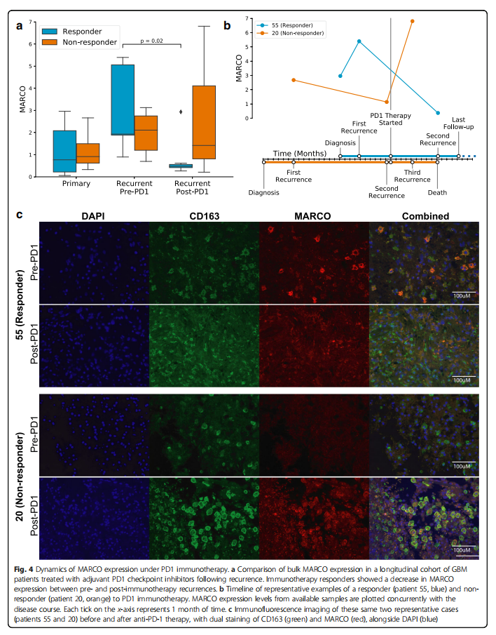 Single-Cell Features of Glioblastoma Macrophages Reveal MARCO as a Stroma-Related Tumor Marker