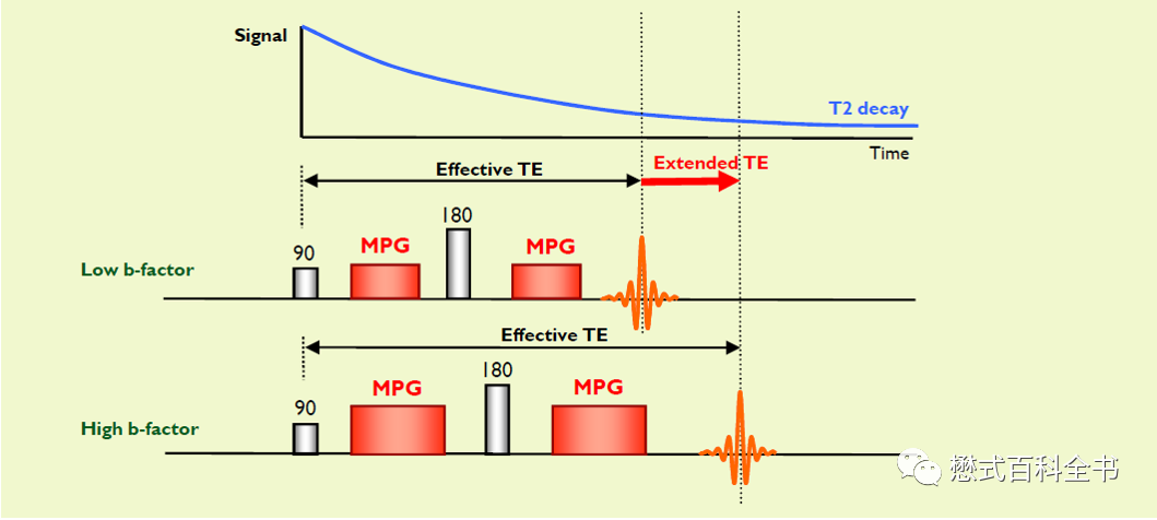Understanding Contrast Parameters in Philips MRI Operations