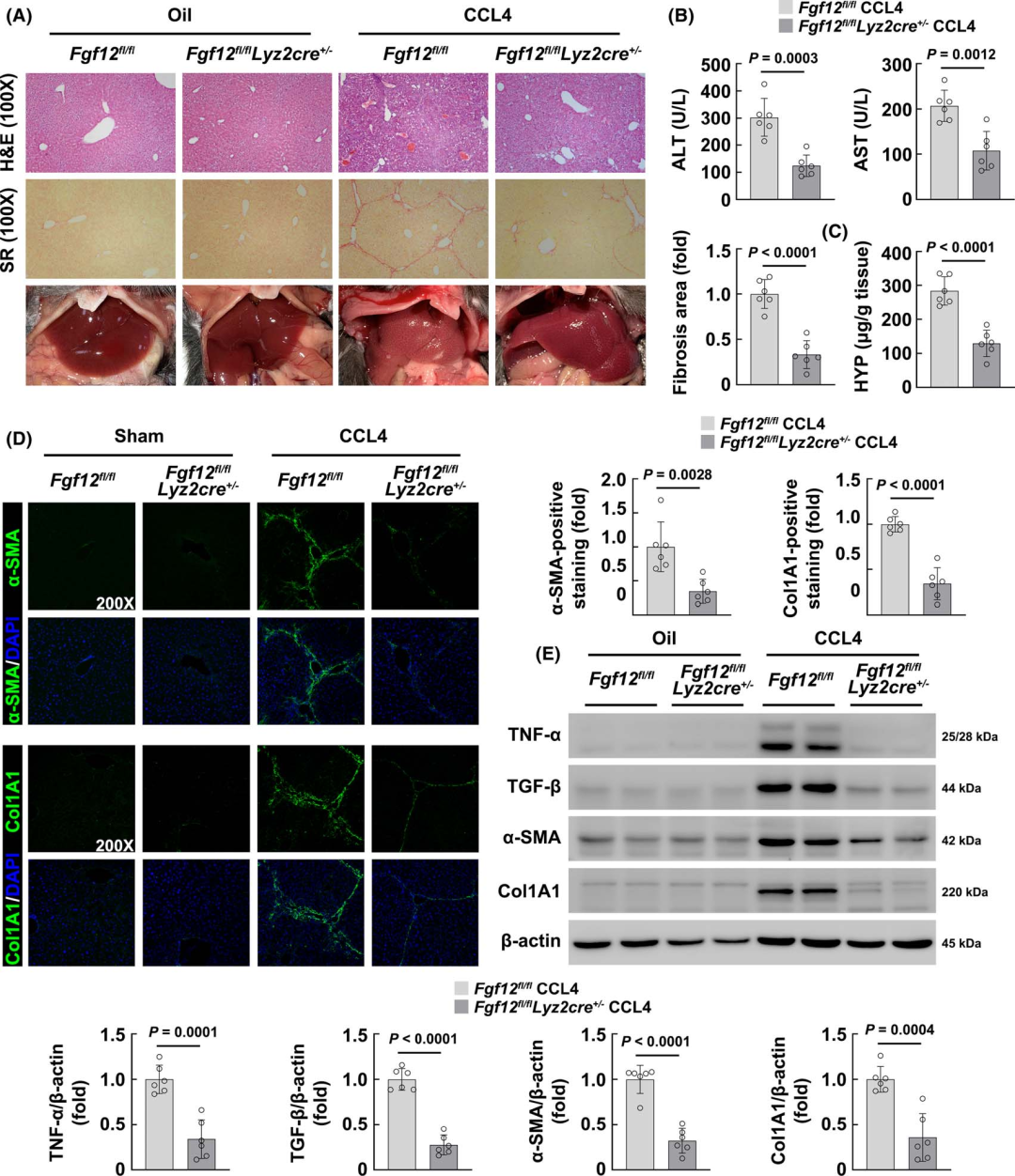 Macrophage-Specific FGF12 Promotes Liver Fibrosis Progression in Mice
