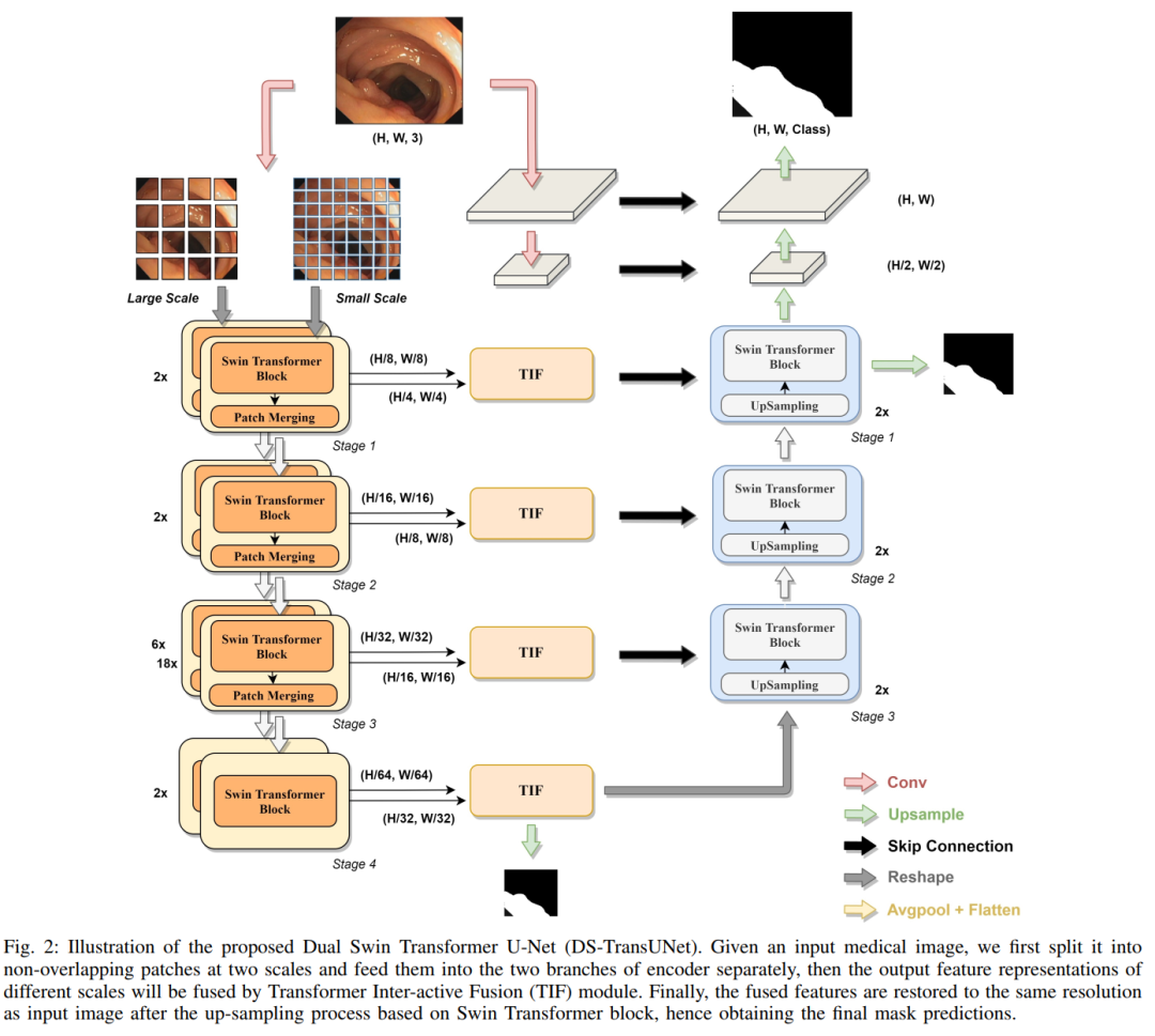 When Transformer Meets U-Net: A Review of Medical Image Segmentation