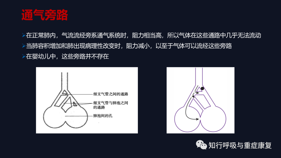 Airway Clearance Techniques - Physiological Basis