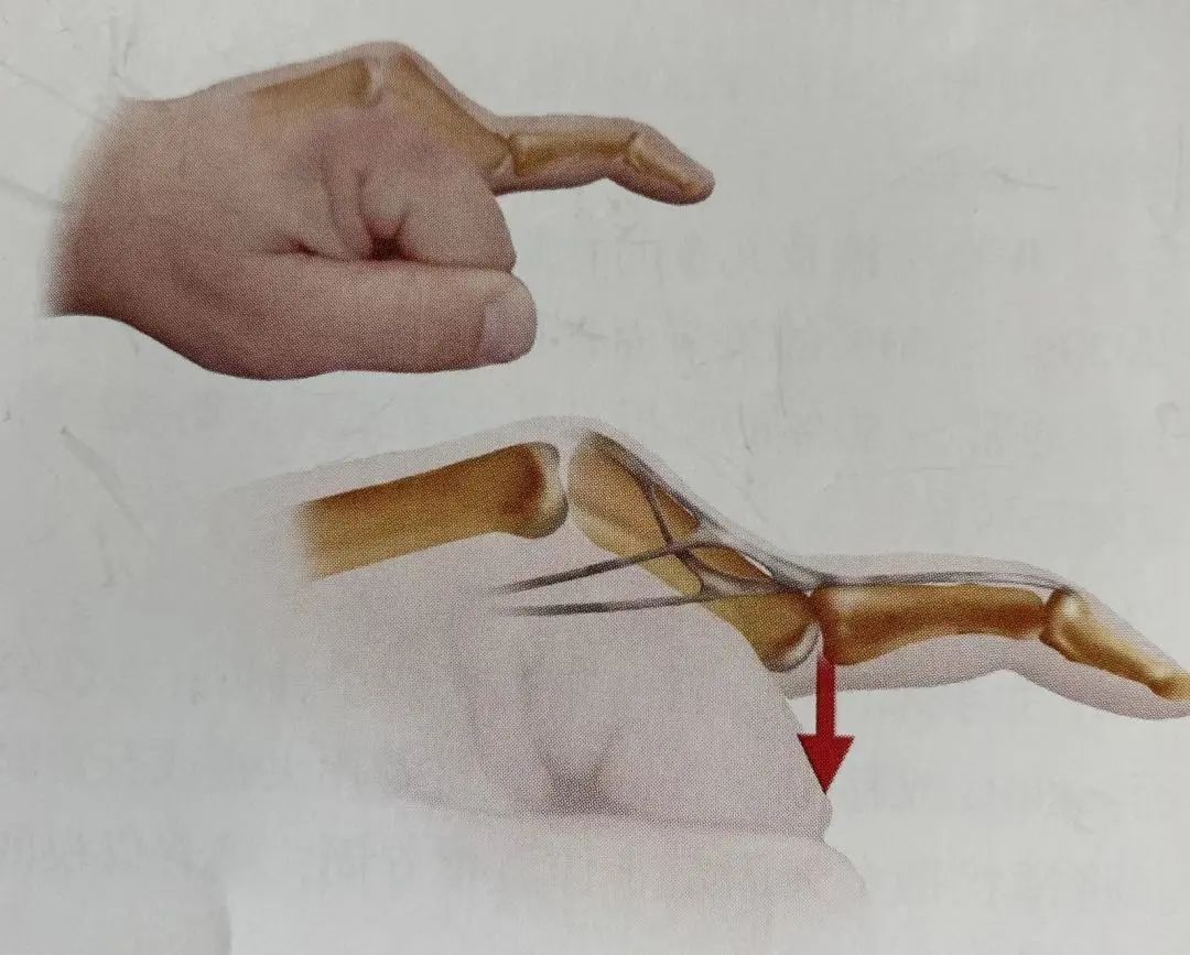 Comprehensive Summary: Treatment Strategies for Four Types of Hand Joint Injuries